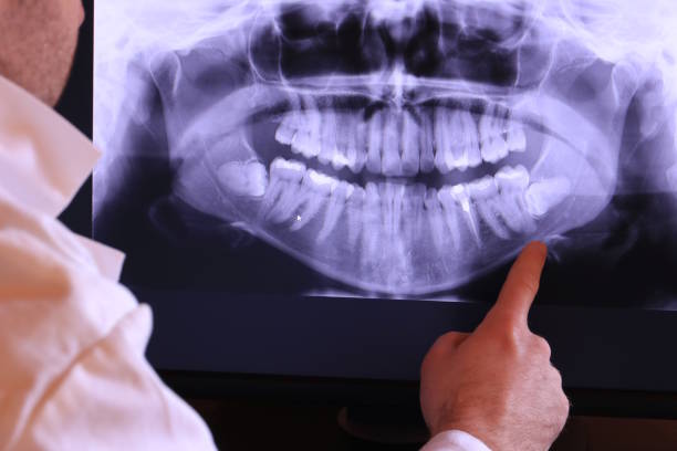 Best Holiday Emergency Dentist in Cadillac, MI