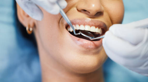 Best Emergency Dentist for Lost Fillings or Crowns in Cadillac, MI